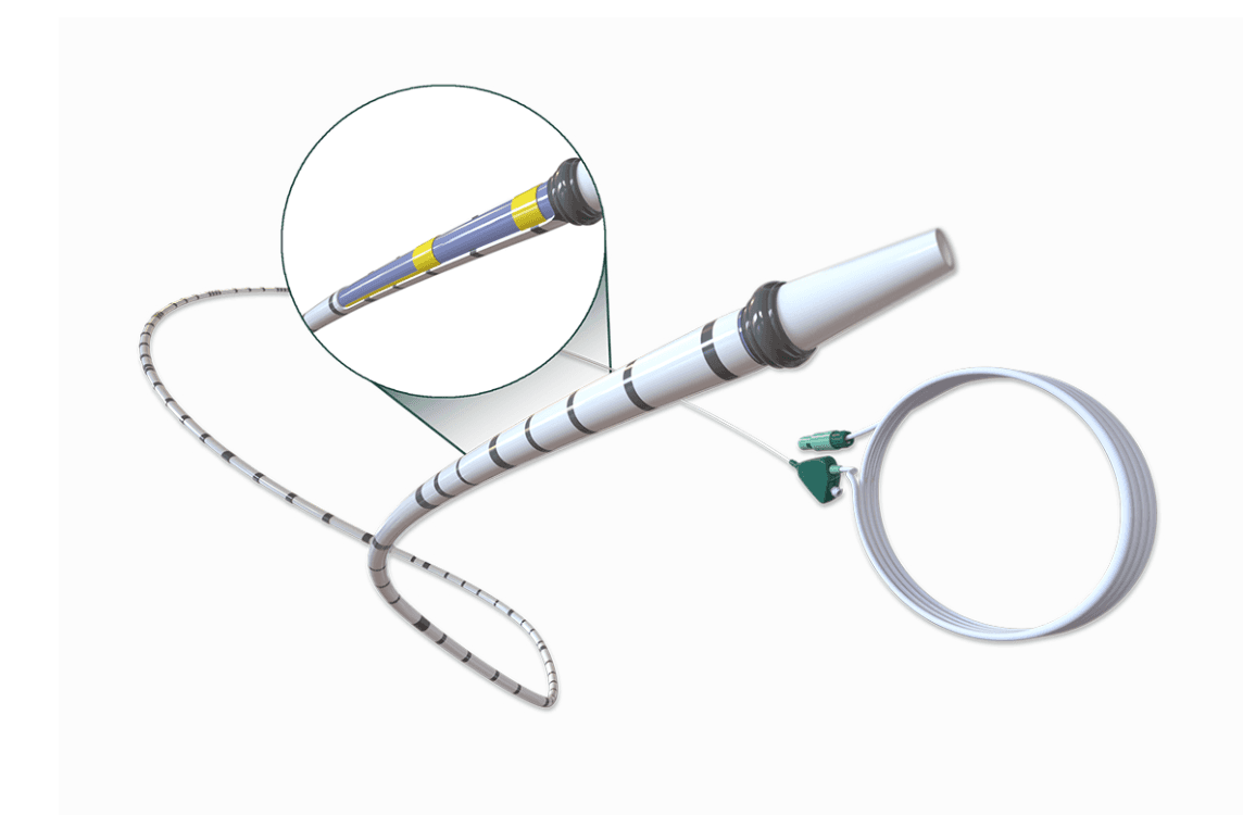 Smart ureteral catheter